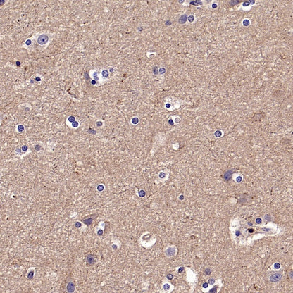 TYK2 Recombinant Rabbit mAb (S-2740-165)
