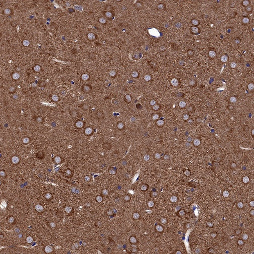 GSK3β Recombinant Rabbit mAb (S-1209-170)