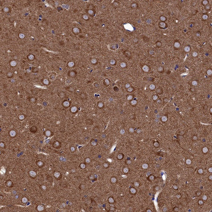 GSK3β Recombinant Rabbit mAb (S-1209-170)