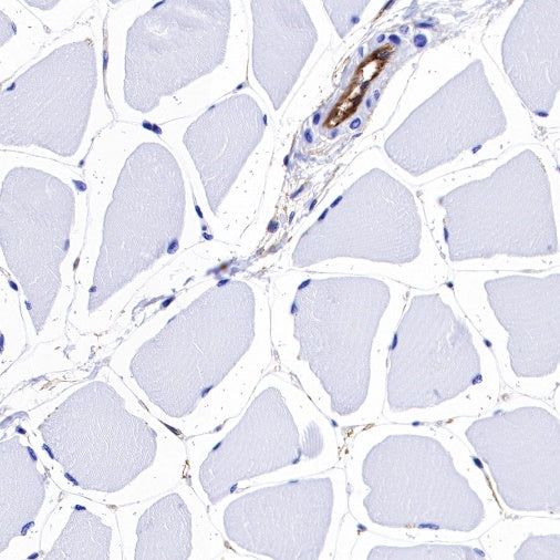 Integrin alpha 5 Recombinant Rabbit mAb (S-381-37)