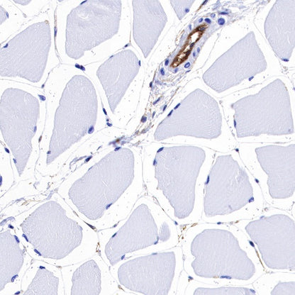 Integrin alpha 5 Recombinant Rabbit mAb (S-381-37)