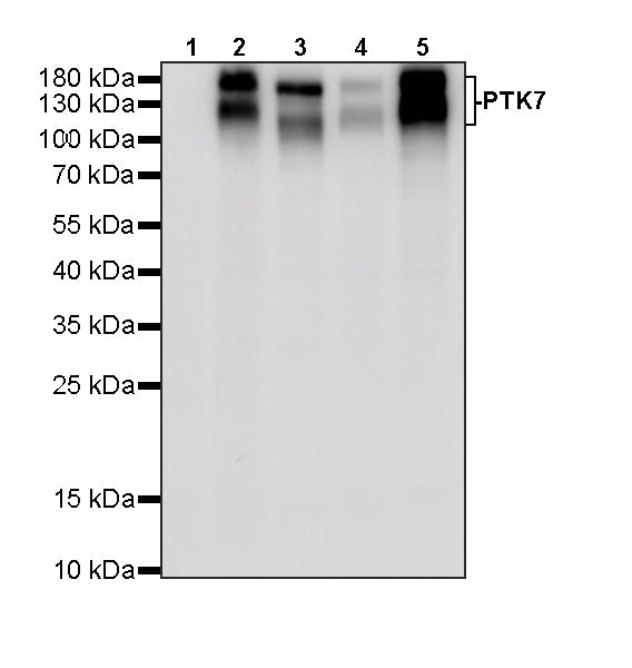 PTK7 Recombinant Rabbit mAb ,PBS Only(SDT-2432-156)