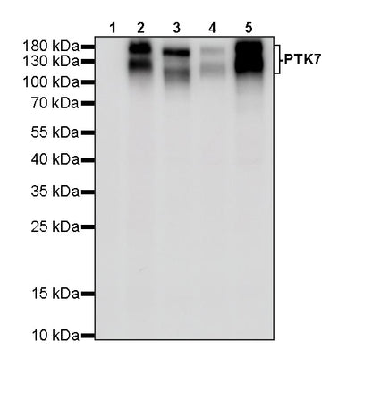 PTK7 Recombinant Rabbit mAb ,PBS Only(SDT-2432-156)