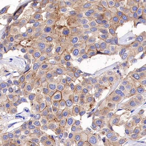 S-RMab® E-Cadherin Recombinant Rabbit mAb (SDT-438-5)