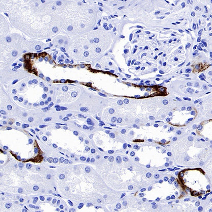 AQP4 Recombinant Rabbit mAb (S-1609-62)