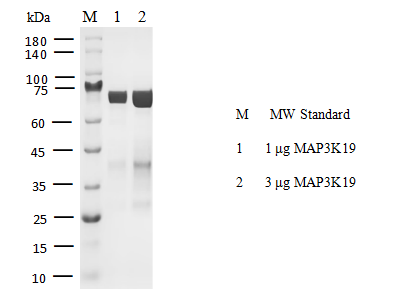 MAP3K19 Protein, Human