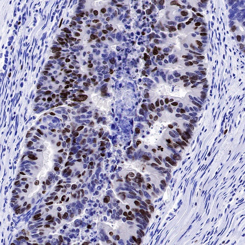 Ki67 Recombinant Mouse mAb (SDT-606-7)
