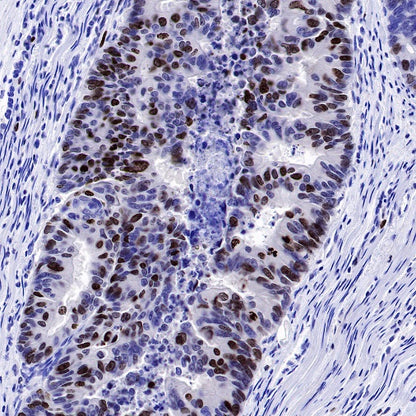 Ki67 Recombinant Mouse mAb (SDT-606-7)