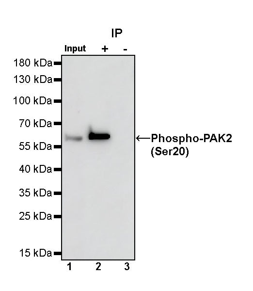 Phospho-PAK2 (Ser20) Recombinant Rabbit mAb (S-507-231)