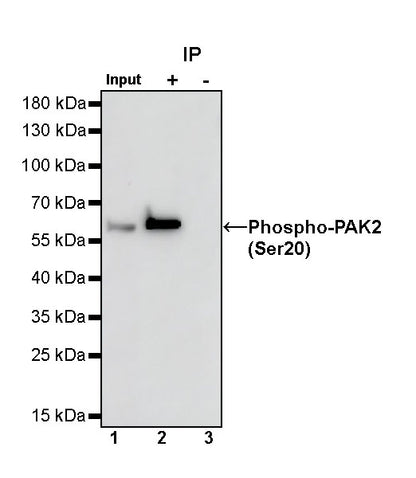 Phospho-PAK2 (Ser20) Recombinant Rabbit mAb (S-507-231)