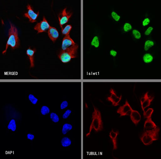 Islet1 Recombinant Rabbit mAb (SDT-2349-17)