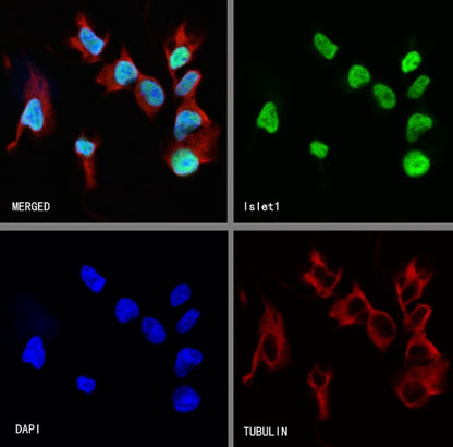 Islet1 Recombinant Rabbit mAb (SDT-2349-17)