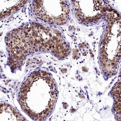 KIF5B+KIF5C Recombinant Rabbit mAb (S-2452-15)