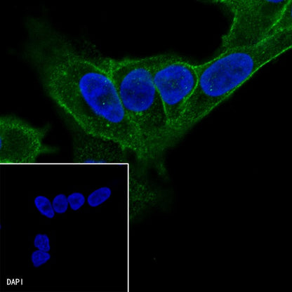 ENT1 Recombinant Rabbit mAb (SDT-R182)