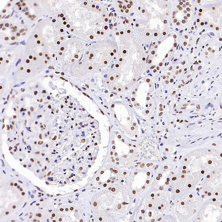 HNRNPL Rabbit Polyclonal Antibody