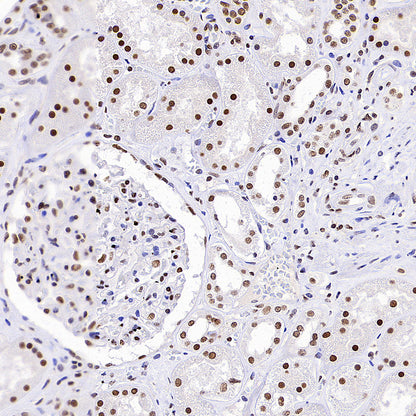 HNRNPL Rabbit Polyclonal Antibody