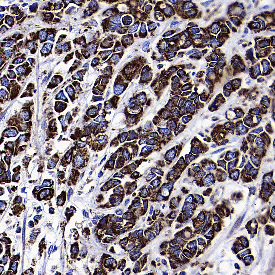 VDAC1 Recombinant Rabbit mAb (S-5314)