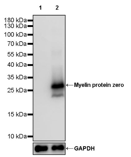 Myelin protein zero Recombinant Rabbit mAb (SDT-1225-8)