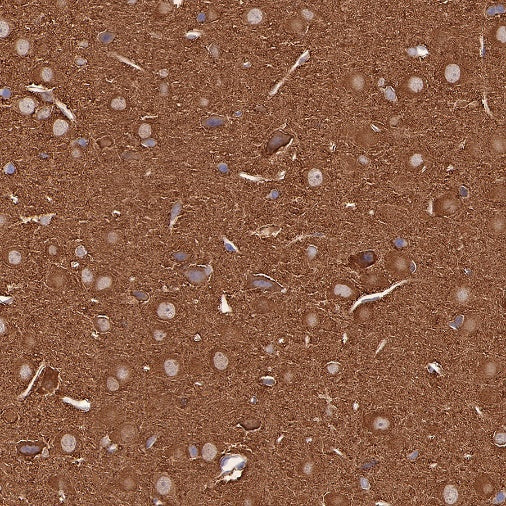 ST13 Recombinant Rabbit mAb (S-661-38)