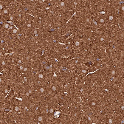 ST13 Recombinant Rabbit mAb (S-661-38)