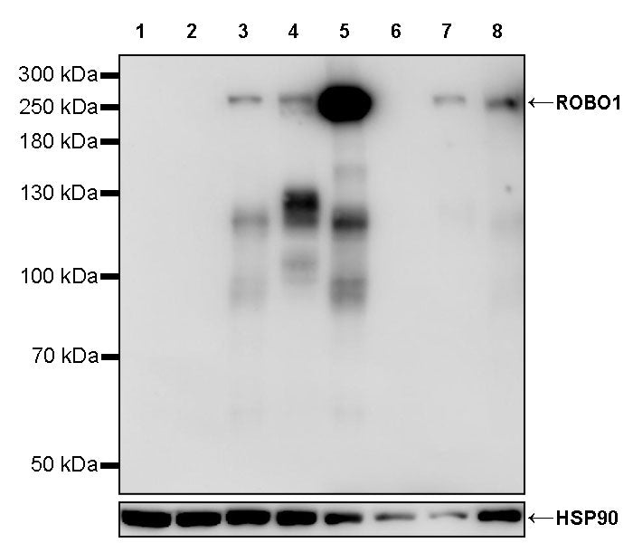 ROBO1 Recombinant Rabbit mAb (S-2931-169)