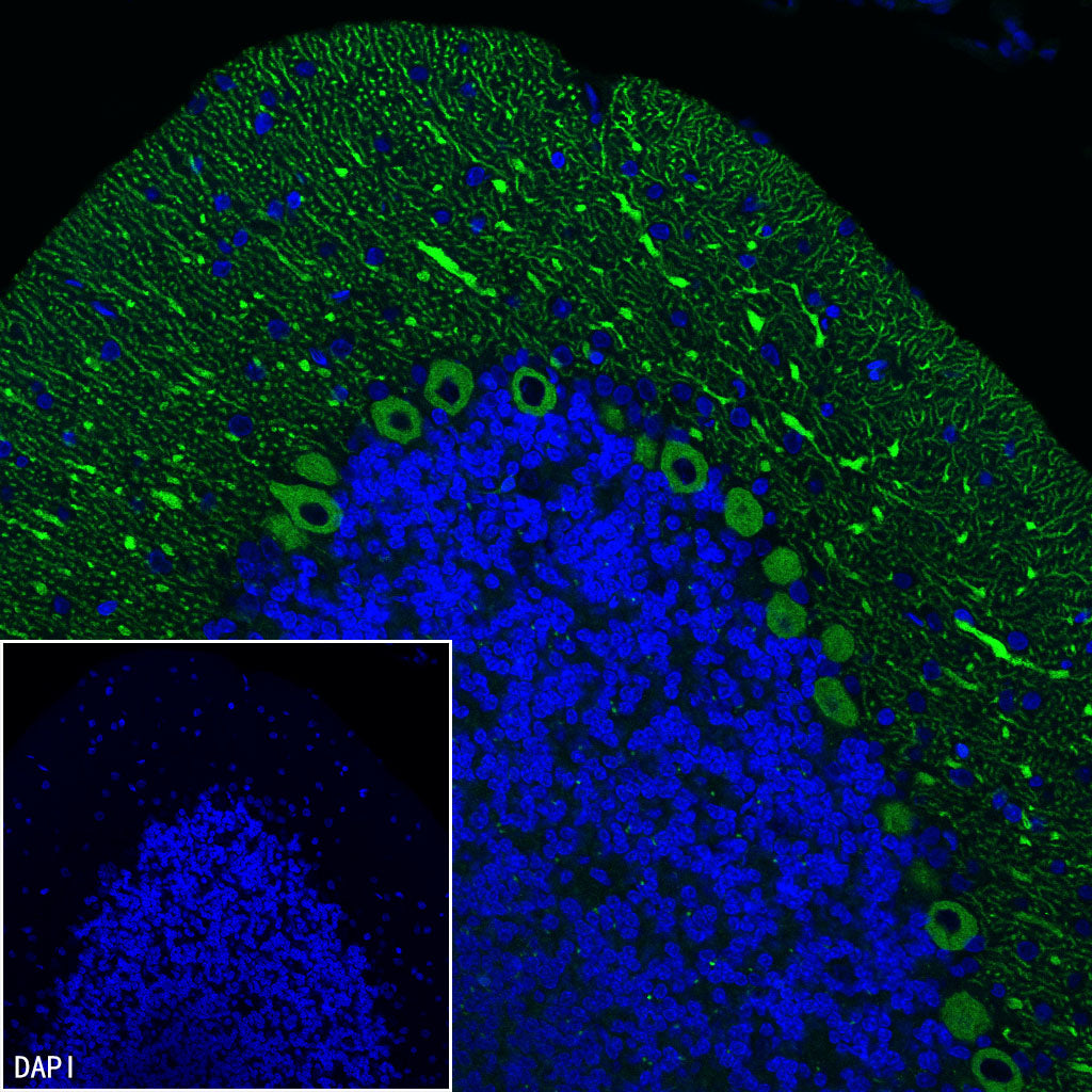ITPR1 Recombinant Rabbit mAb (S-4530-47)