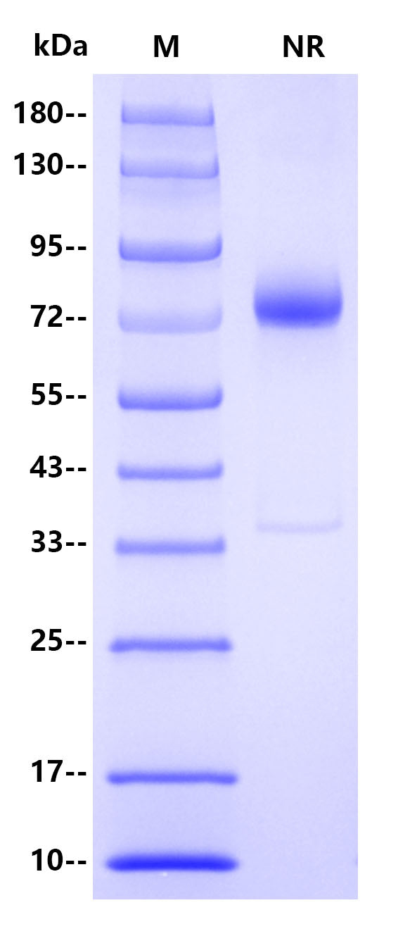 Human IL-12 p70 Protein, His Tag