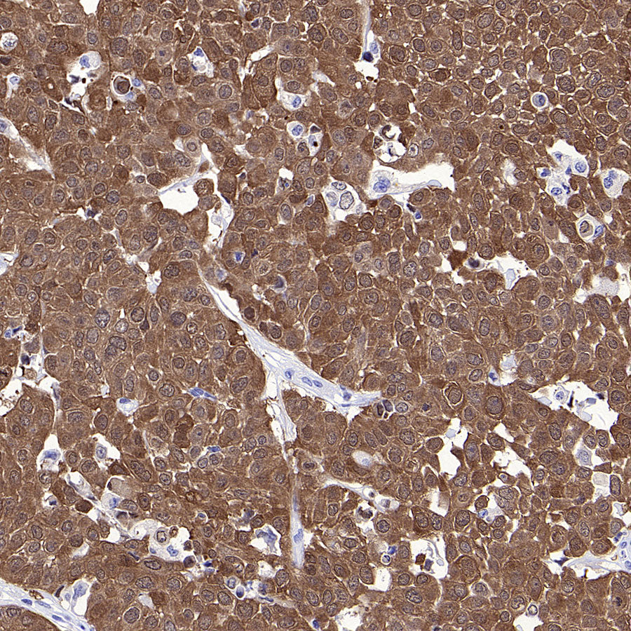 MAGE-A4 Recombinant Rabbit mAb (S-3868-66)