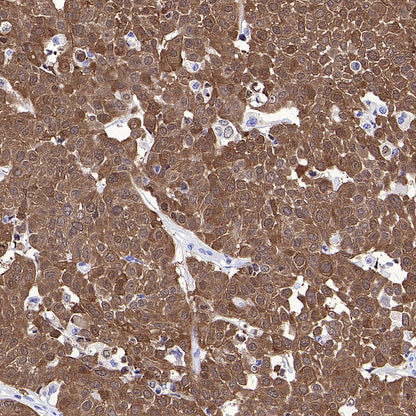 MAGE-A4 Recombinant Rabbit mAb (S-3868-66)