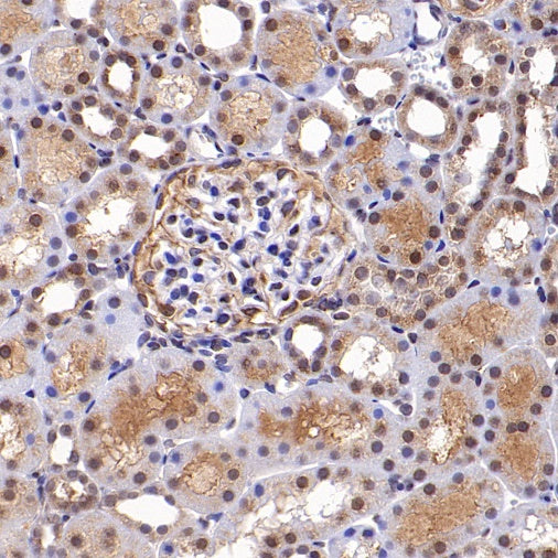 SMAD2 Rabbit Polyclonal Antibody