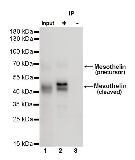 Mesothelin Recombinant Rabbit mAb (SDT-347-15)
