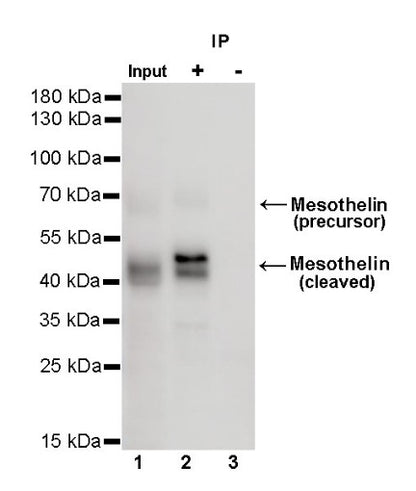Mesothelin Recombinant Rabbit mAb (SDT-347-15)