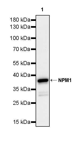 NPM1 Recombinant Rabbit mAb (S-4119-58)