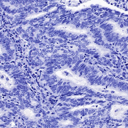 S-RMab® Helicobacter pylori Recombinant Rabbit mAb (SDT-R273)