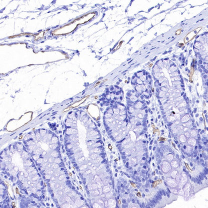 PODXL Recombinant Rabbit mAb (S-2014-9)