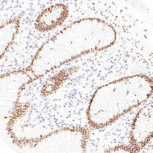 FOXP4 Recombinant Rabbit mAb (S-6198)