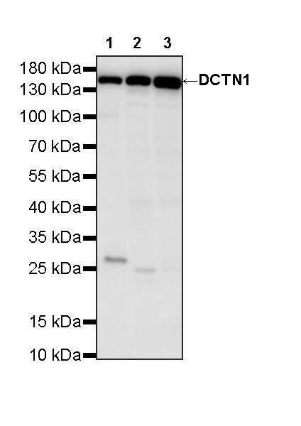 DCTN1 Rabbit Polyclonal Antibody