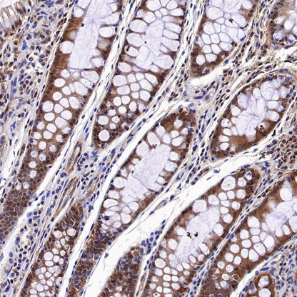 MEK1/2 Recombinant Rabbit mAb (S-834-101)