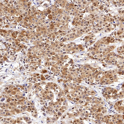 ACLY/ATP citrate lyase Recombinant Rabbit mAb (S-2025-32)