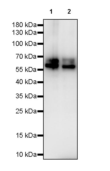 Cytokeratin 1 Recombinant Rabbit mAb (SDT-3225-22)