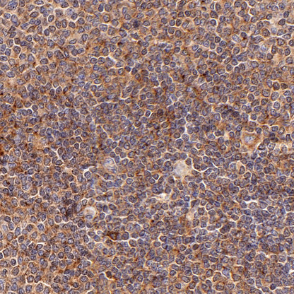 Moesin Rabbit Polyclonal Antibody