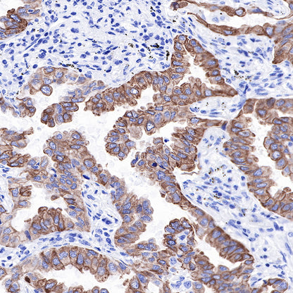 S-RMab® Keratin 18 Recombinant Rabbit mAb (SDT-012-7)