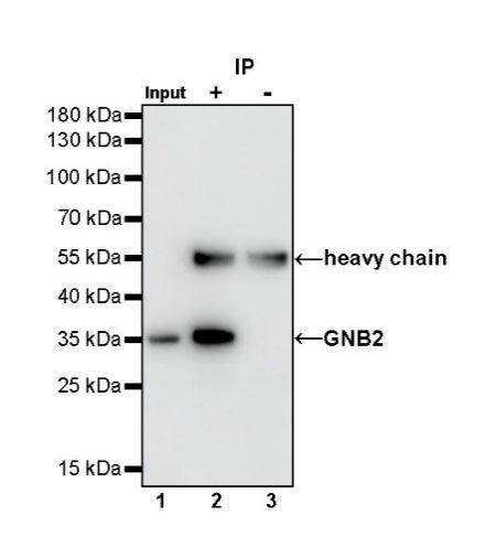 GNB2 Recombinant Rabbit mAb (S-645-10)