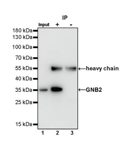 GNB2 Recombinant Rabbit mAb (S-645-10)