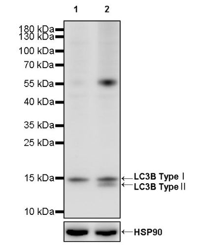 LC3B Recombinant Rabbit mAb (S-1599-142)