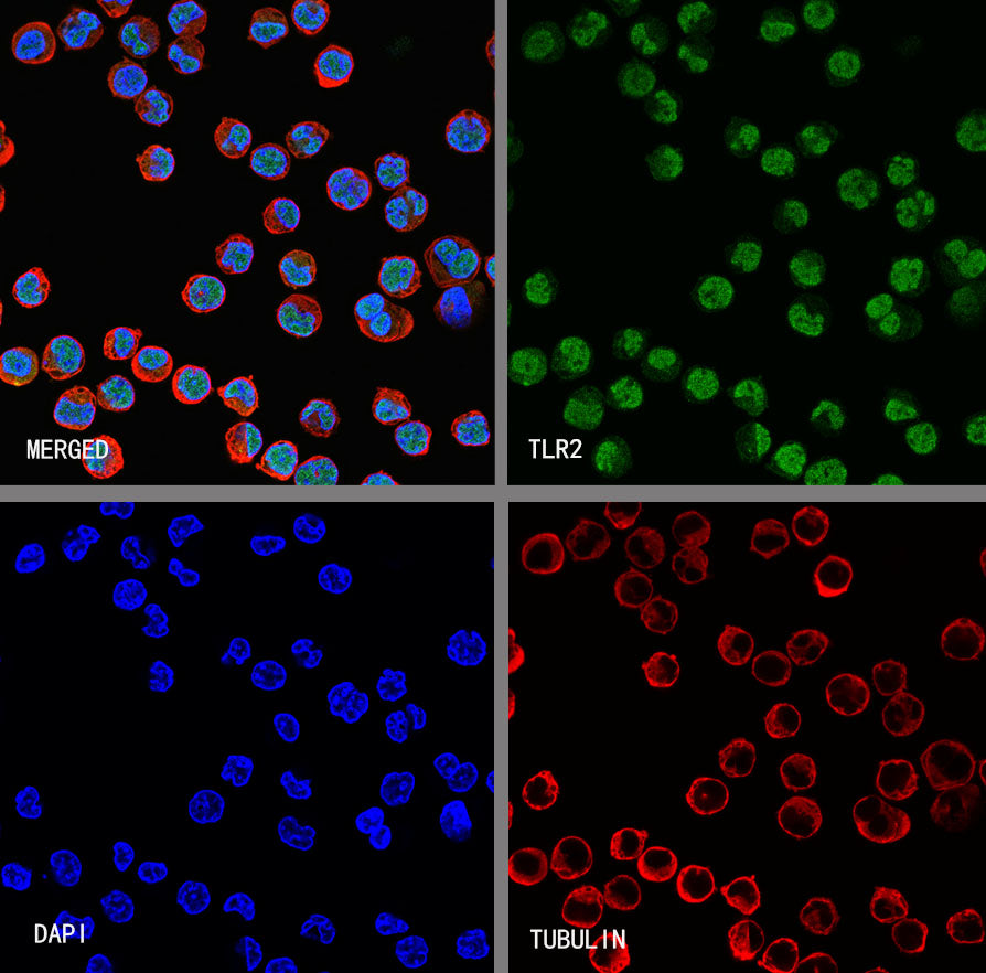 GST-π Recombinant Rabbit mAb (SDT-R054)