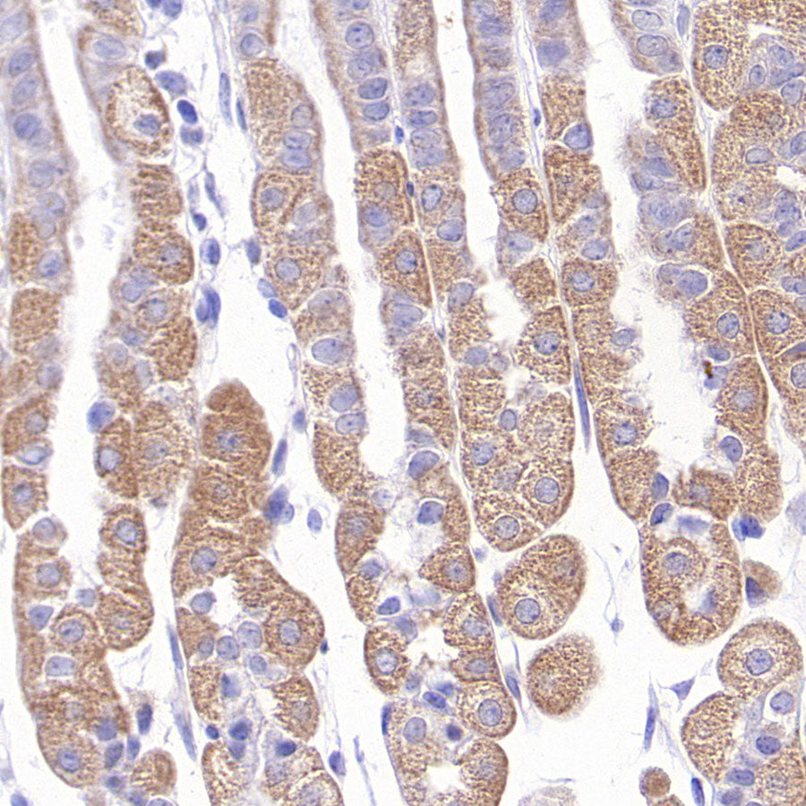 TOM20 Recombinant Rabbit mAb (S-M0015)