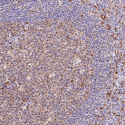 LC3B Recombinant Rabbit mAb (S-1599-142)