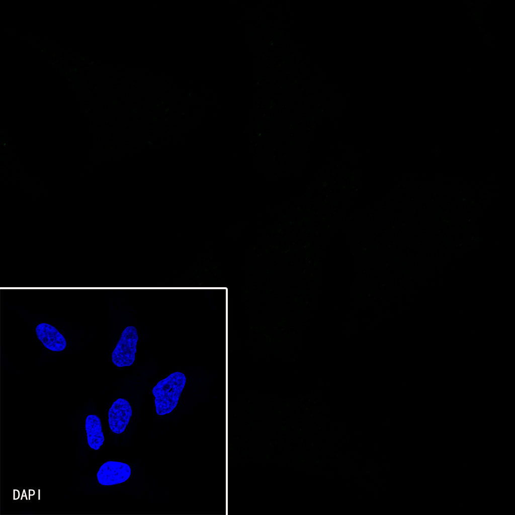 HNF4α Recombinant Rabbit mAb (SDT-373-64)