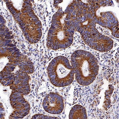 UQCRC2 Recombinant Rabbit mAb (S-1890-227)
